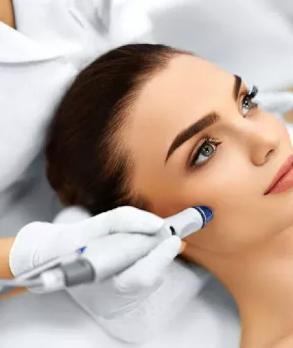 microneedling